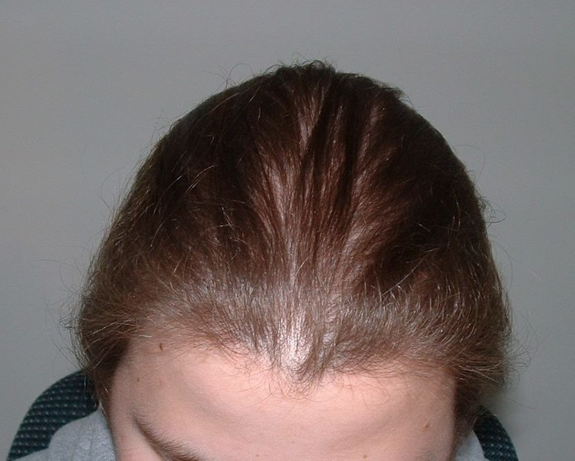Overall Hair Health